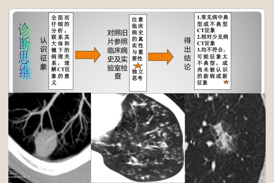 肺部病变的常见的CT征象诊断课件_第3页