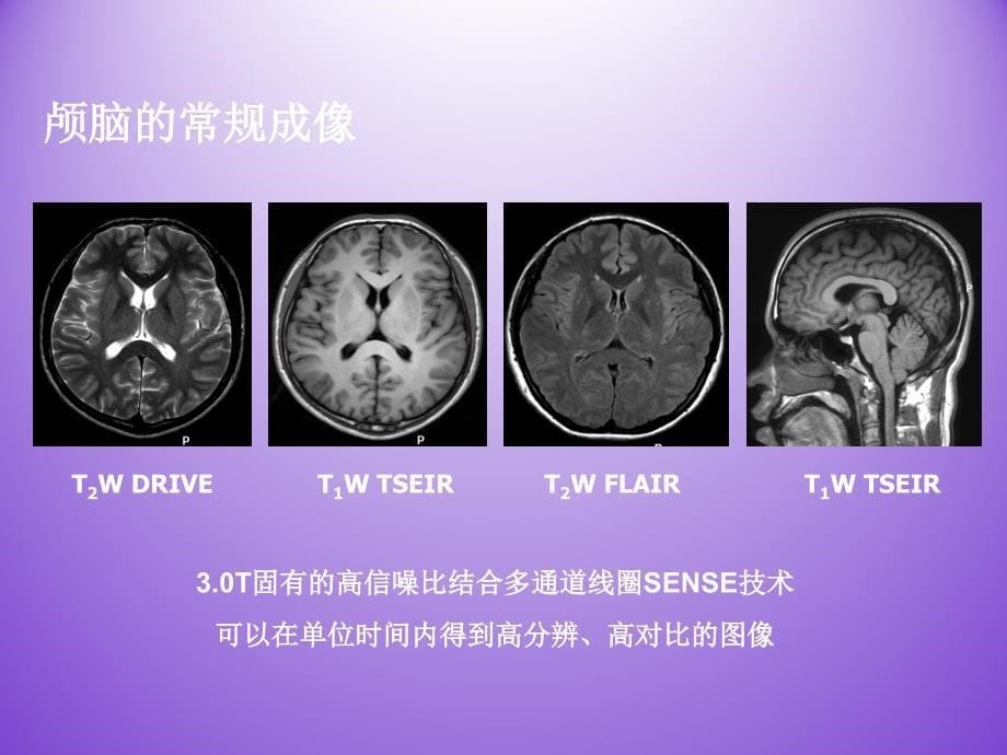 3.0TMR在骨关节及神经系统临床应用_第5页