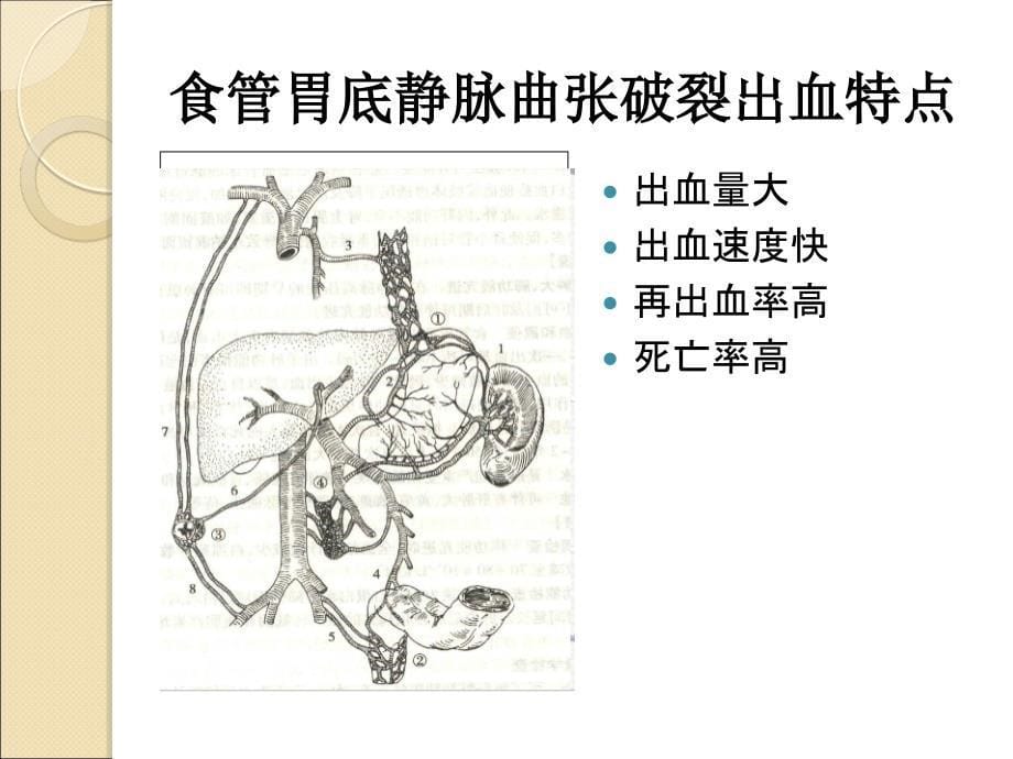 三腔二囊管的安置与护理资料课件_第5页