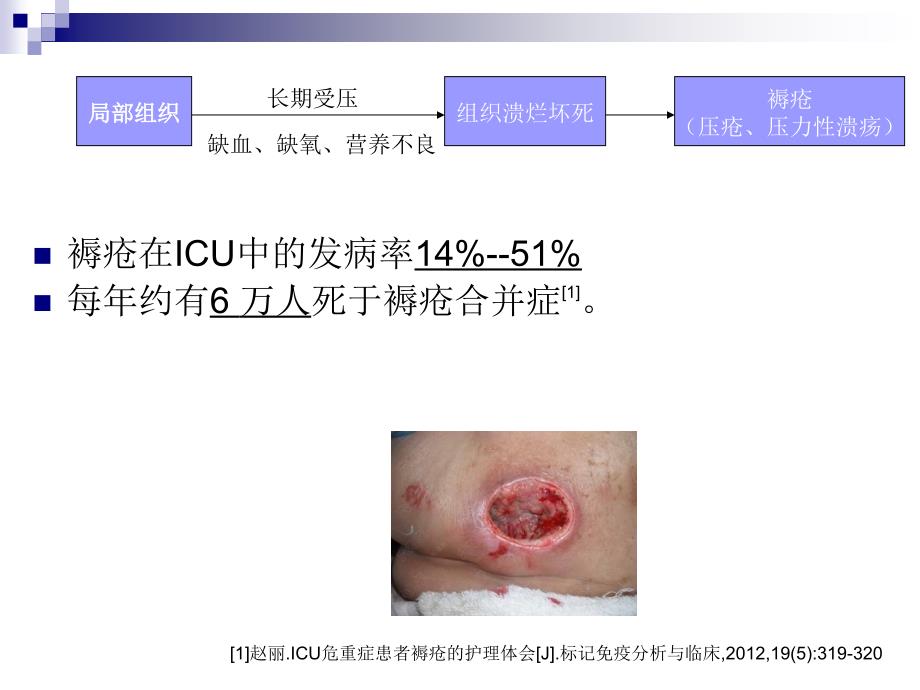 利福平在褥疮治疗中的作用_第2页