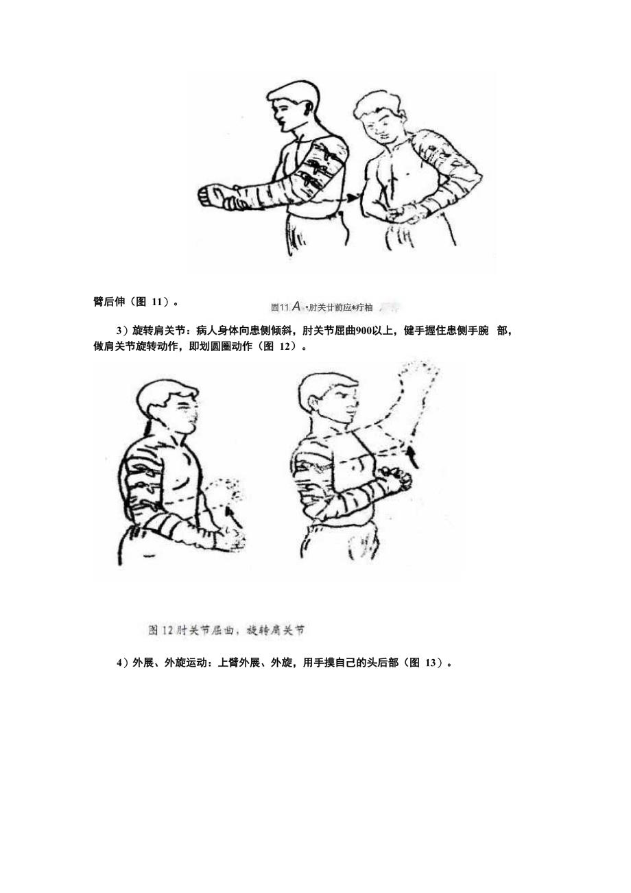 肱骨干骨折康复训练_第2页