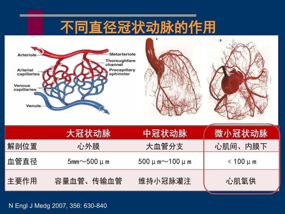 冠状动脉微血管病变及对策_第5页