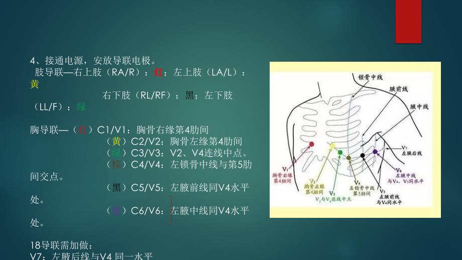 心电图分析步骤和报告_第3页