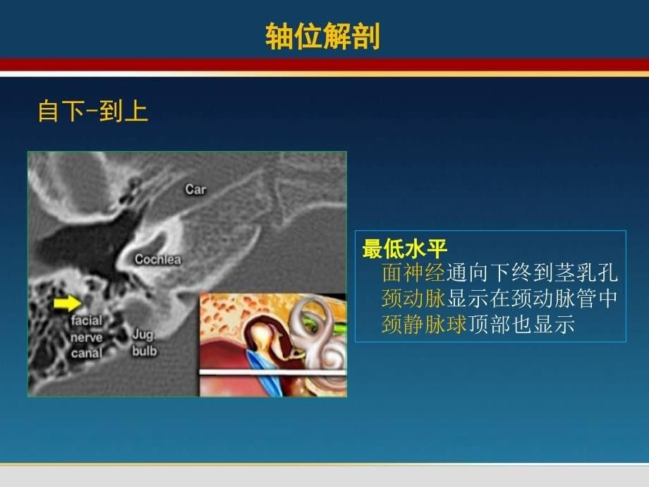 颞骨翻译马国林整理中文ppt课件_第5页