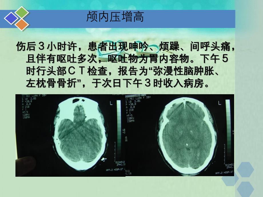 新版颅内压增高病例_第4页