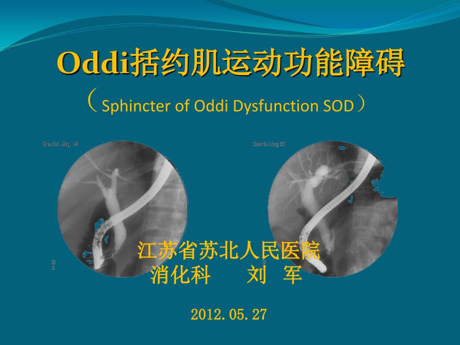 Oddi括约肌运动功能障碍_第1页