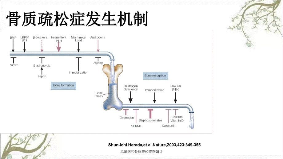 风湿病和骨质疏松症李娟讲课件_第5页