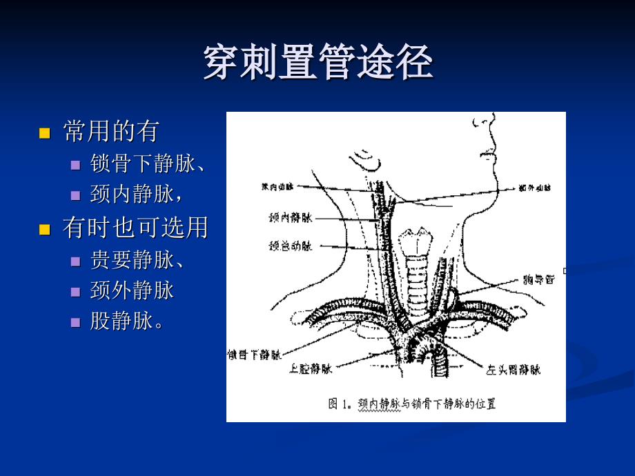 中心静脉穿刺置管通用课件_第4页