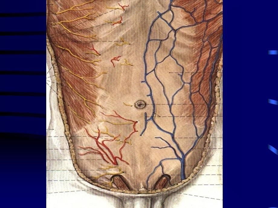 08腹壁及腹腔探察_第5页