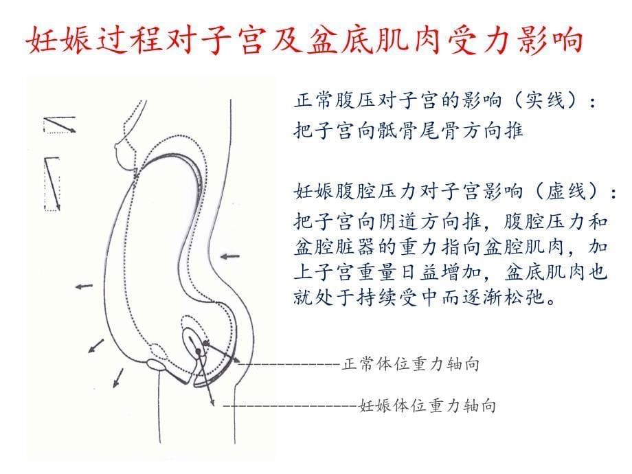 盆底功能障碍及康复治疗PPT课件_第5页