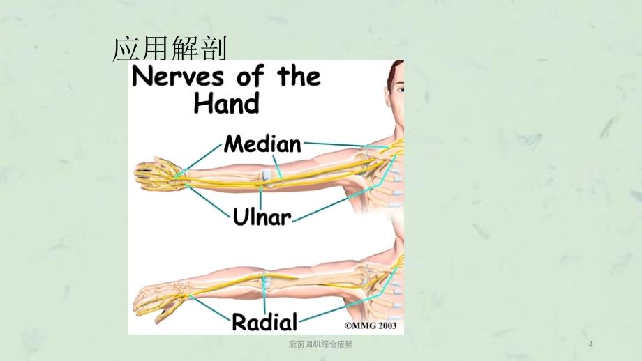 旋前圆肌综合症精课件_第4页