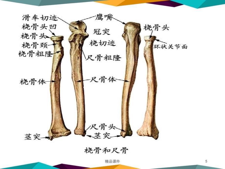 尺桡骨骨折的护理医学课件_第5页