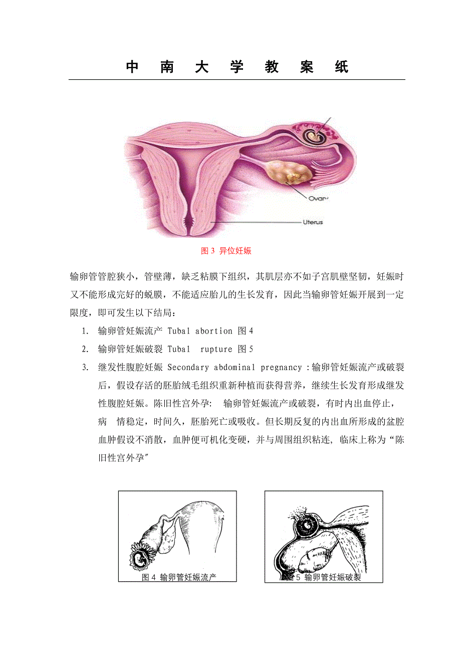 中 南 大 学 教 案 纸 科 目】妇产科学 授课教师】李菡 授课对象】_第4页