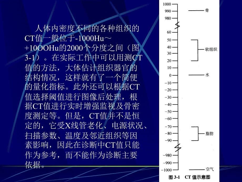 医学课件第二部分CT图像_第5页