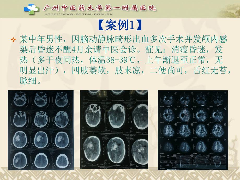 温病理法方药临床应用举隅131226_第2页