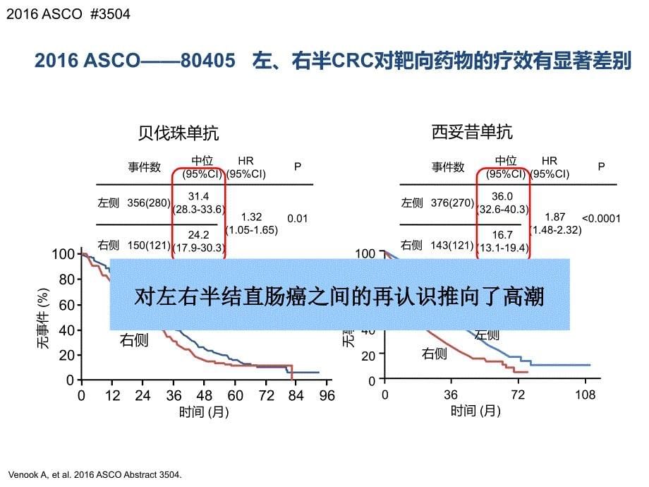 话说左右半结直肠癌_第5页