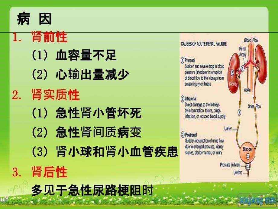 急性肾衰竭病人的抢救护理_第5页