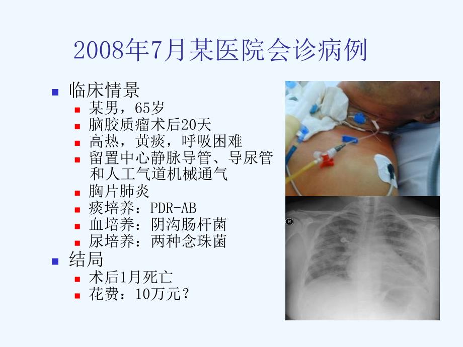 ICU医院感染控制的规范化管理课件_第2页