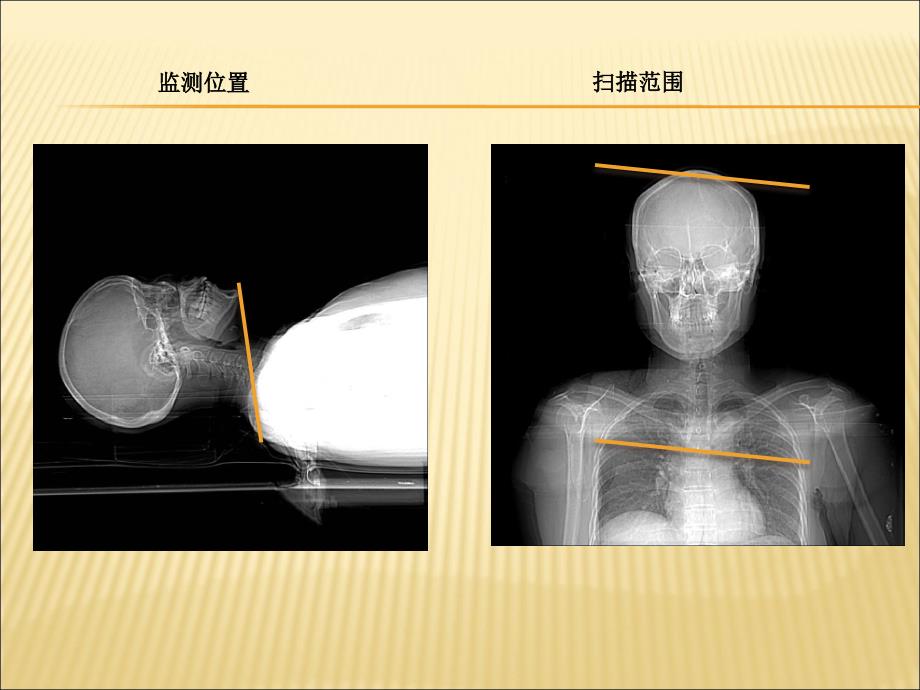 头颈部CTA课件PPT_第4页