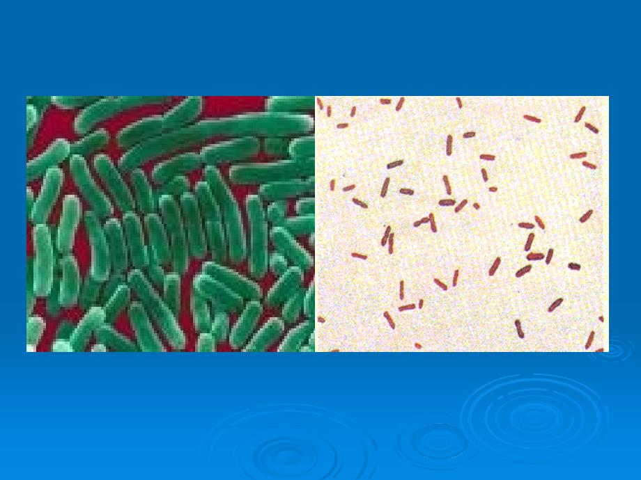 医学微生物学教学课件：志贺菌属_第3页