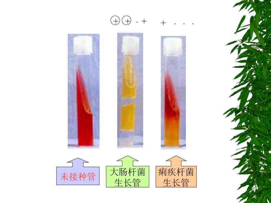 医学微生物学教学课件：志贺菌属_第4页