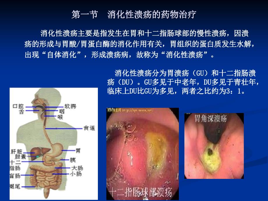 消化系统常见疾病的药物治疗重点难点辅导课件_第2页