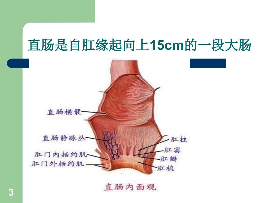 直肠癌的护理ppt课件_第3页