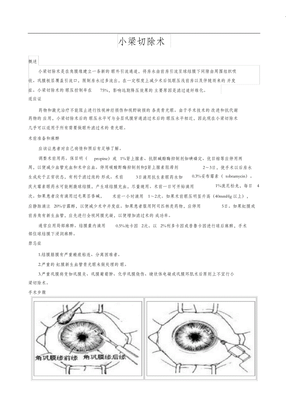 （完整版）小梁切除术_第1页