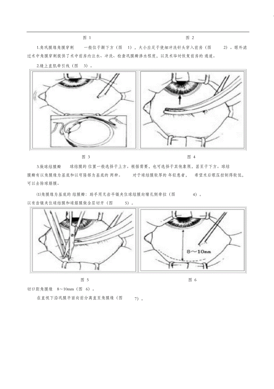 （完整版）小梁切除术_第2页