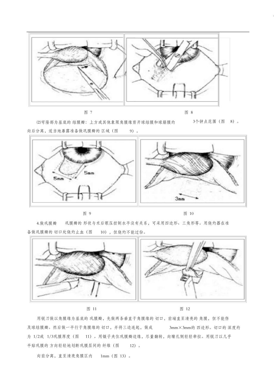 （完整版）小梁切除术_第3页