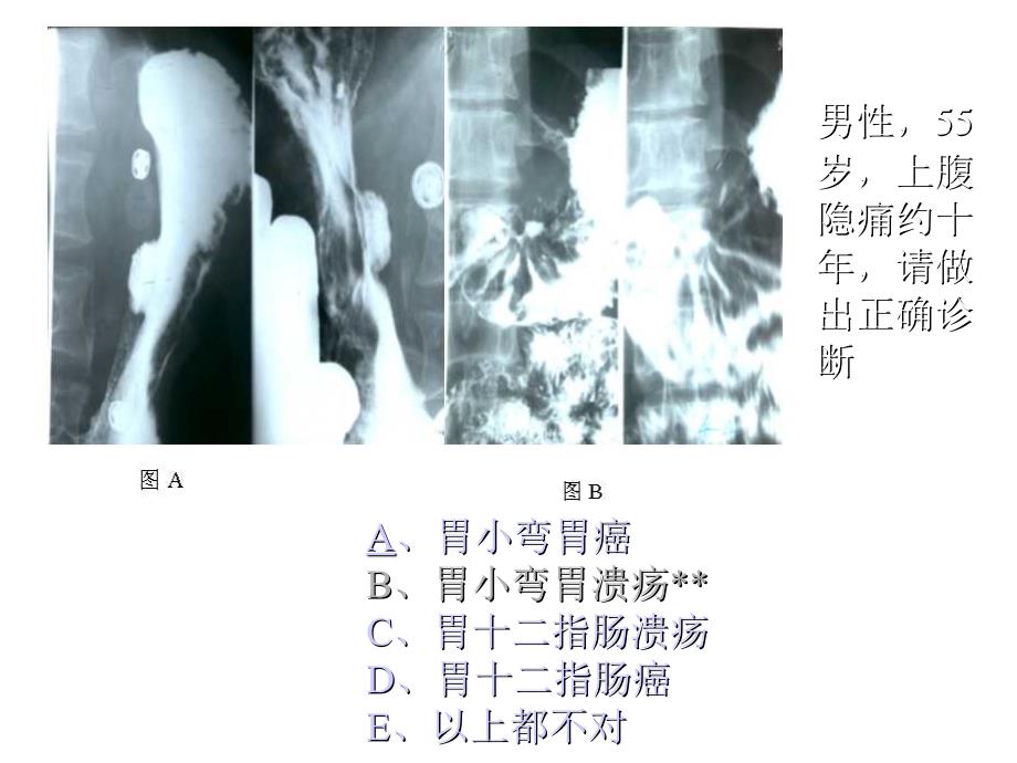 执业医师操作考试(X光片)_第4页