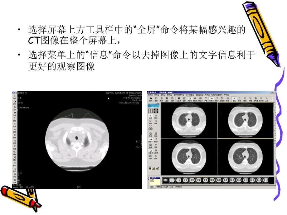 医学图像后处理技术_第5页