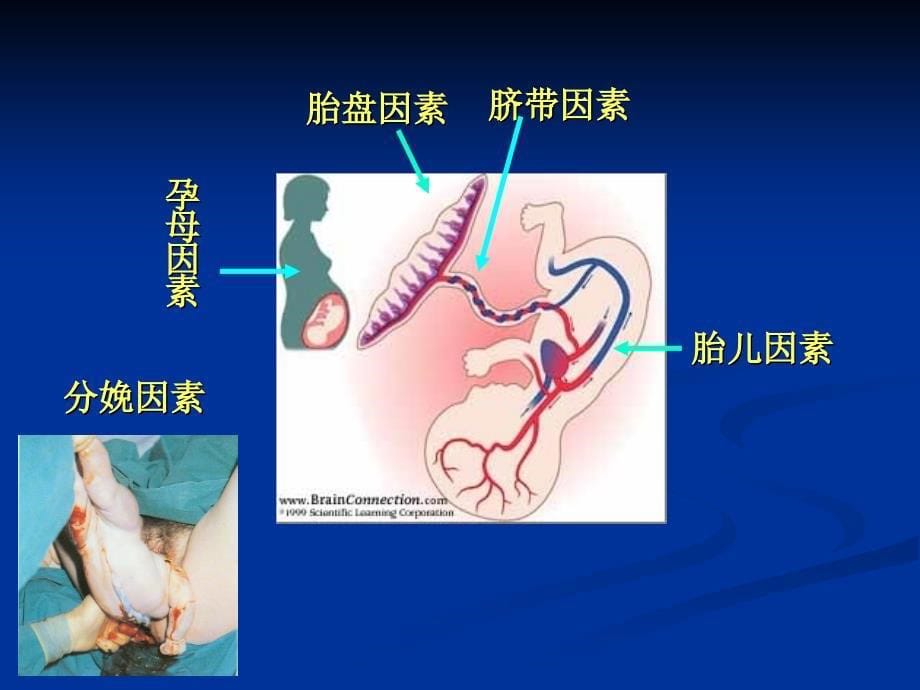 儿科学新生儿窒息课件_第5页