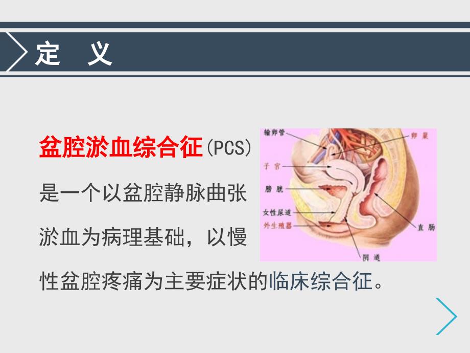 盆腔淤血综合征_第2页