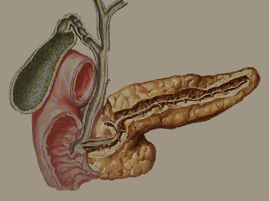 《重症胰腺炎诊治》PPT课件_第5页