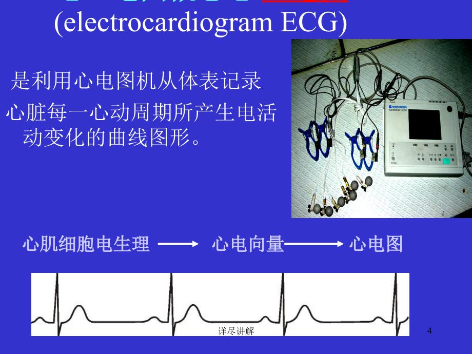 心电图基础知识讲座深度分析_第4页