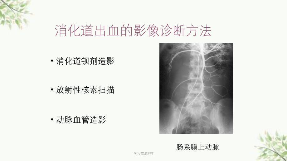 消化道出血介入治疗课件_第3页