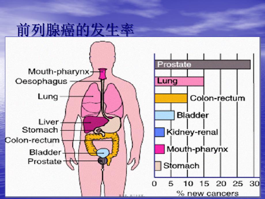 医学专题—前列腺癌诊治进展20859_第2页