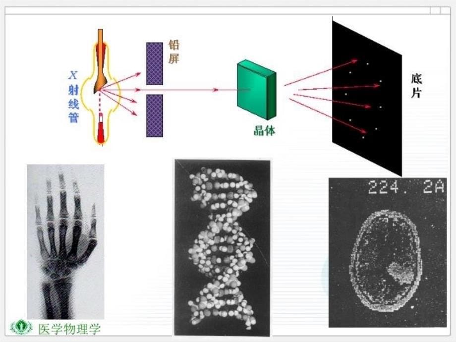 最新十三X射线PPT课件_第5页