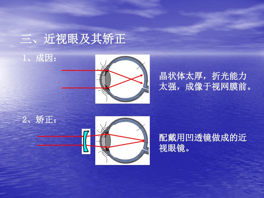 54眼睛和眼镜课件_第5页