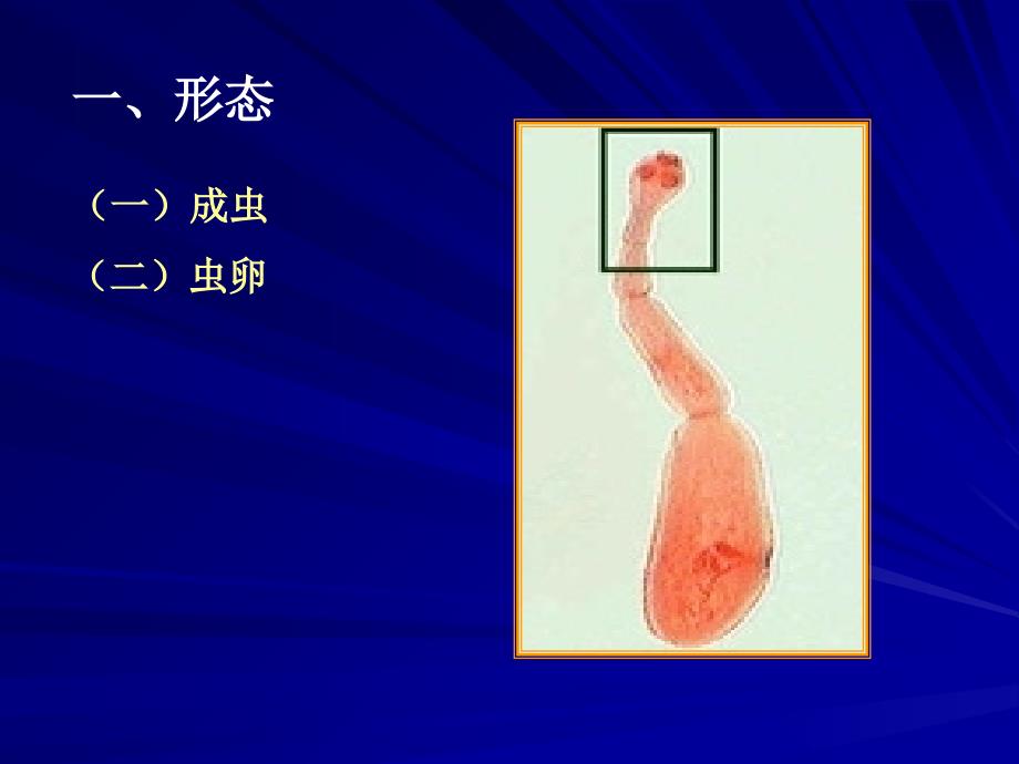 医学寄生虫学394细粒棘球绦虫_第3页