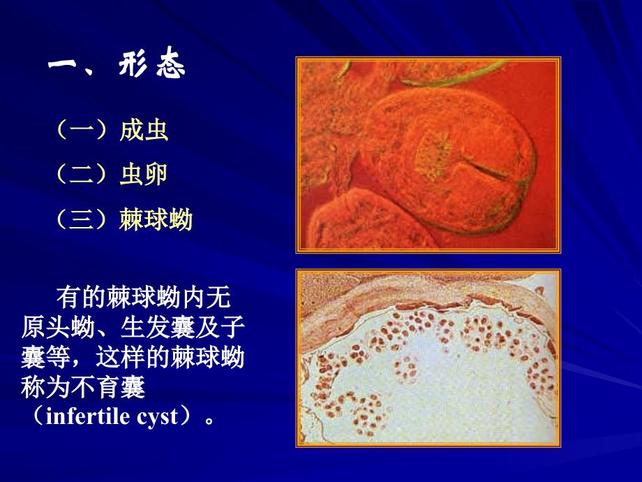 医学寄生虫学394细粒棘球绦虫_第4页