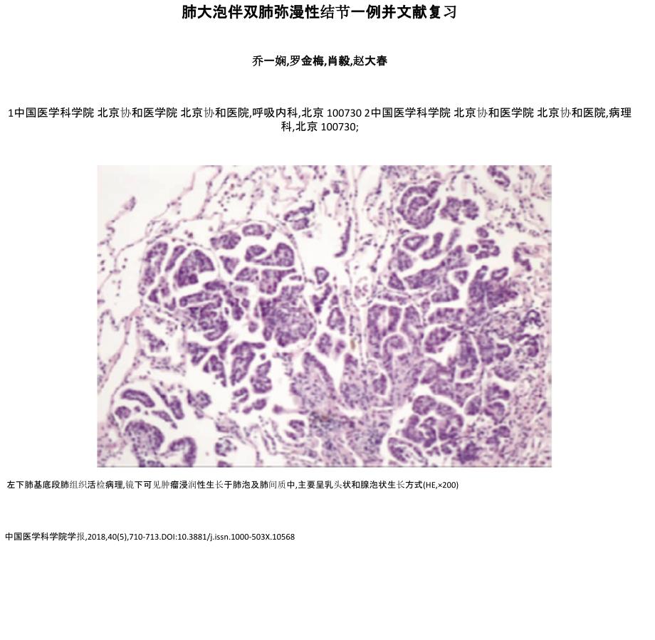 肺大泡伴双肺弥漫性结节一例并文献复习_第1页