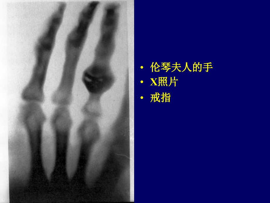 第一章X射线衍射分析_第2页