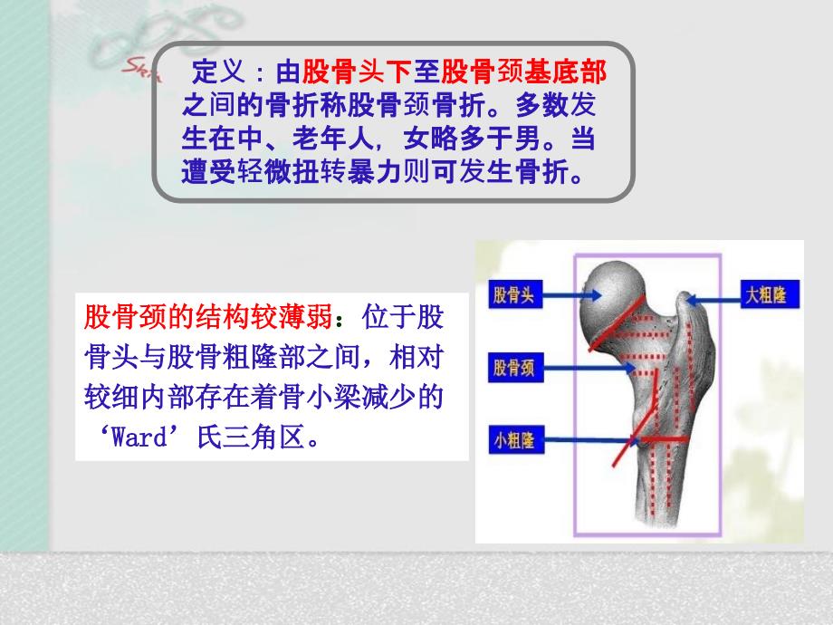 髋关节置换术后护理20271_第2页