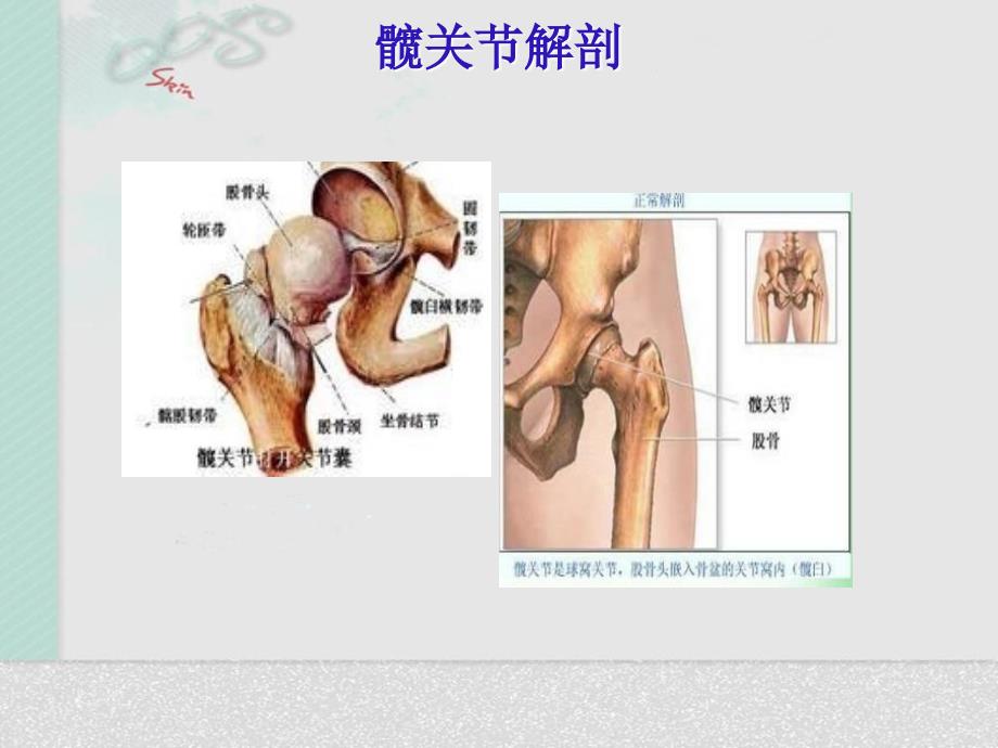 髋关节置换术后护理20271_第3页