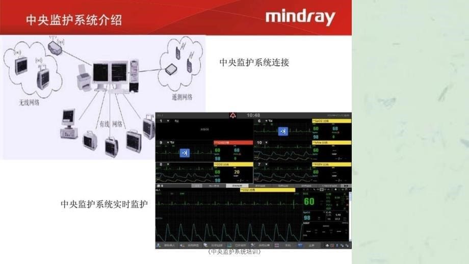 中央监护系统培训课件_第5页