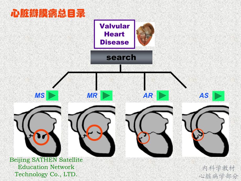 最全心脏瓣膜病课件.ppt_第3页