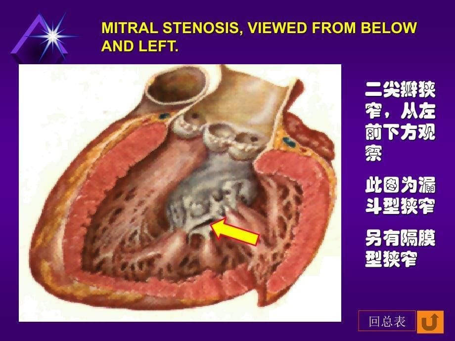 最全心脏瓣膜病课件.ppt_第5页