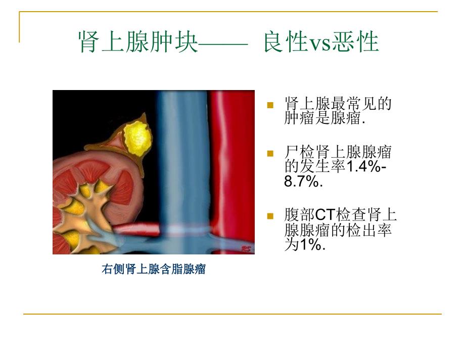 肾上腺占位的CT鉴别诊断_第3页